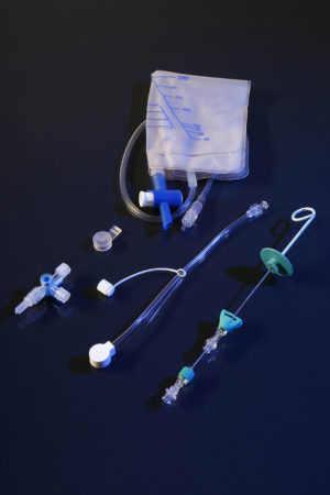 ascites