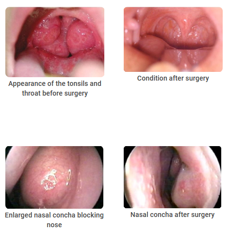 ENT – CRYO-S Electric