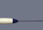 Radio Frequency Thyroid – RF Thyroid Ablation