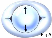 The Bonhoeffer MULTI-TRACK™ System