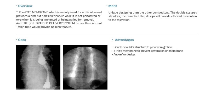 EGIS Oesophageal Stent