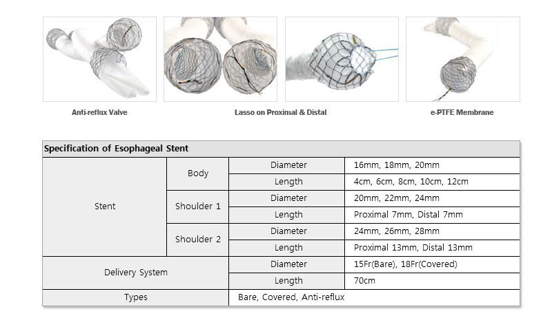 EGIS Oesophageal Stent