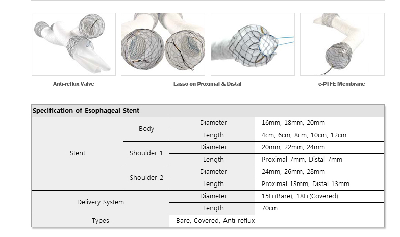 EGIS Oesophageal Stent
