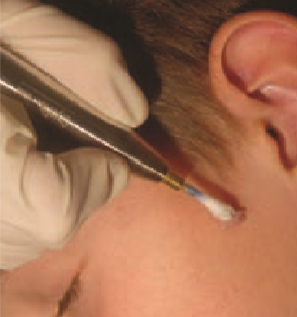 dermatology