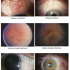 ophthalmology