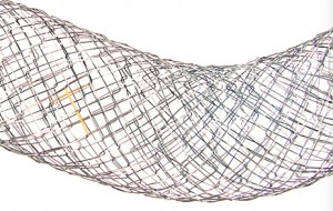 pyloric